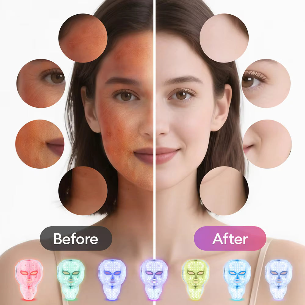 LED Photon Rejuvenation Face Mask